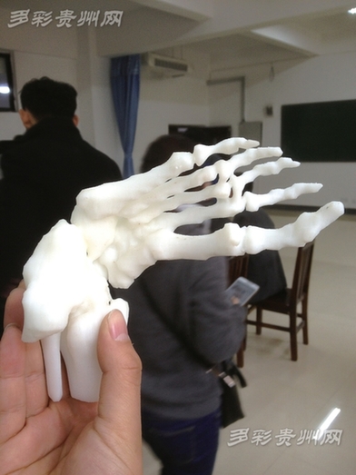 贵师大与省医签约合作 3D打印骨骼 手术精准(图)